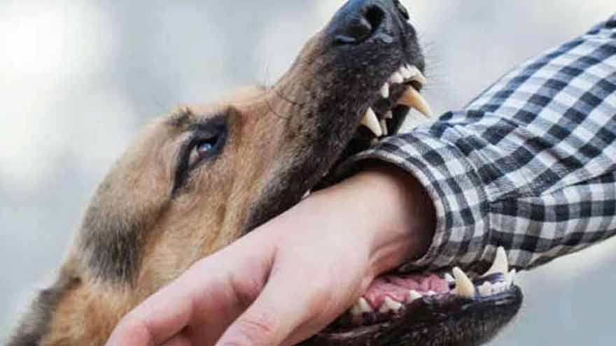 Updated on21 Aug 26, 12:11:54 PKTSummaryA 24-year-old Karachi man has died of rabies after a stray